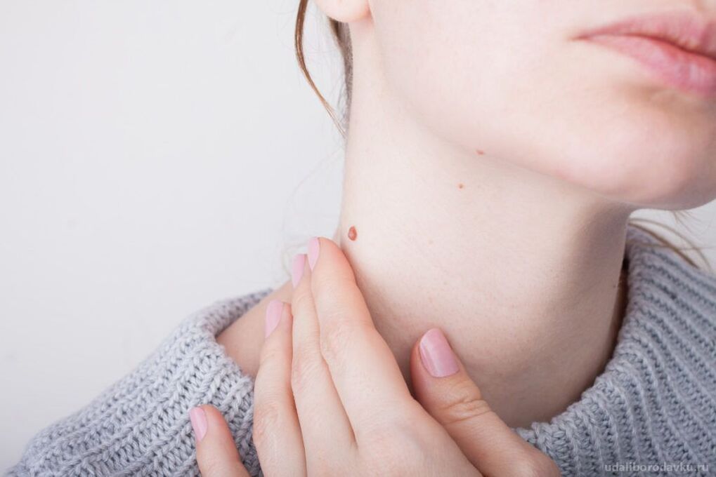 HPV patoģenēze
