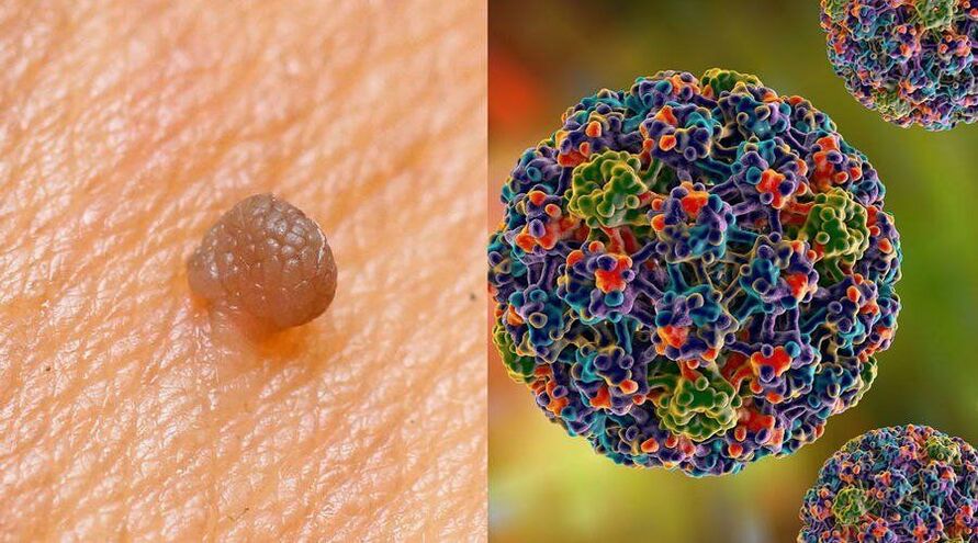 HPV pārnešanas ceļi